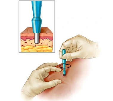 03Biopsies