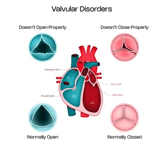 HeartValvularDisease